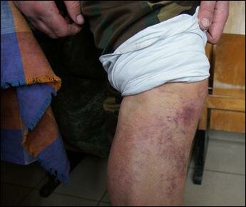 «Деда», избивавшего солдат в Бресте, осудили на полтора года