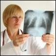 Туберкулез вновь бросает вызов медицине